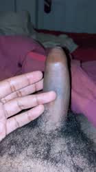 My tight foreskin