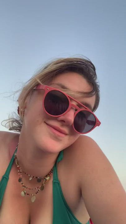 sunburned