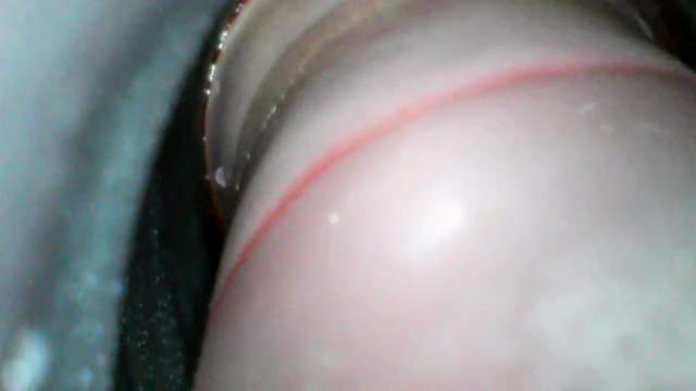 taking the pump off of my menstruating cervix
