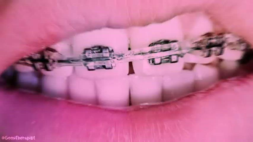 braces cum cumshot cute gif