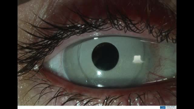 iris