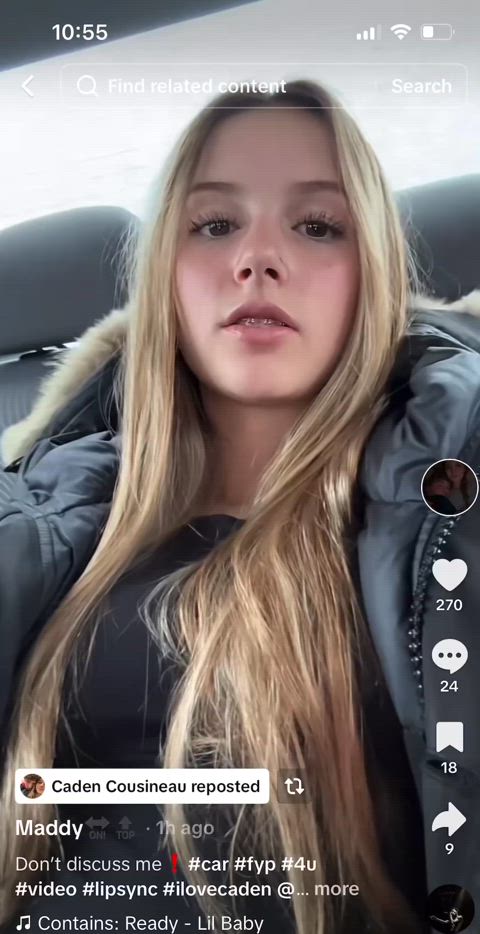 blonde braces cute gif