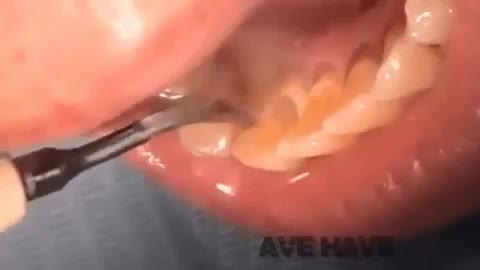 clb0xIE