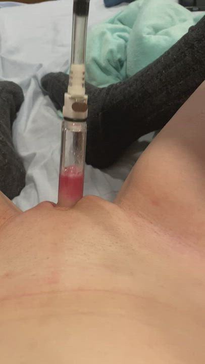 Clit Pump FTM Trans gif