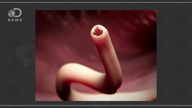 How Worms Survive Inside Your Body
