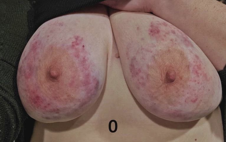 bdsm bruise kinky masochism masochist real-bdsm gif