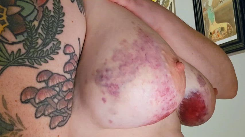 bdsm bruise kinky real-bdsm gif