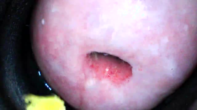 standard-issue wasabi (horseradish) on a chopstick in my cervix