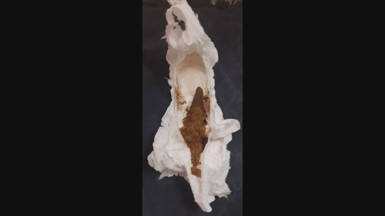 Diaper Poop Diary #1
