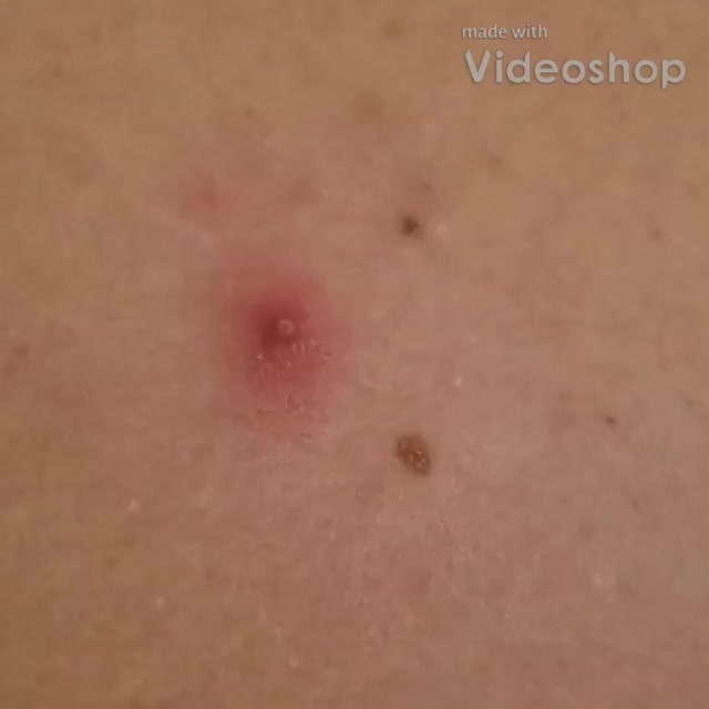 2018-4-28-19-18-44