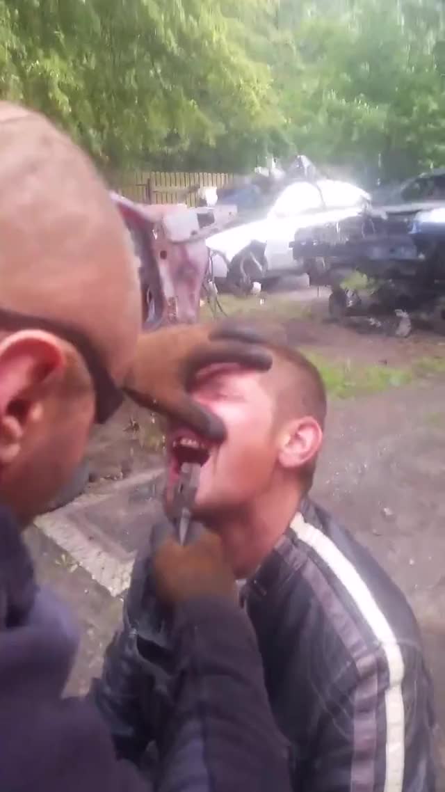 Extracting tooth with pliers polish way
