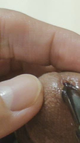 E stim